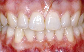 dentale-klasse-2-n