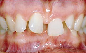 dentale-klasse-2