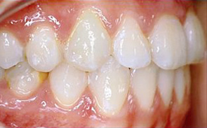 dentale-klasse-3-n