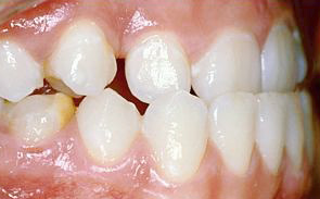dentale-klasse-3